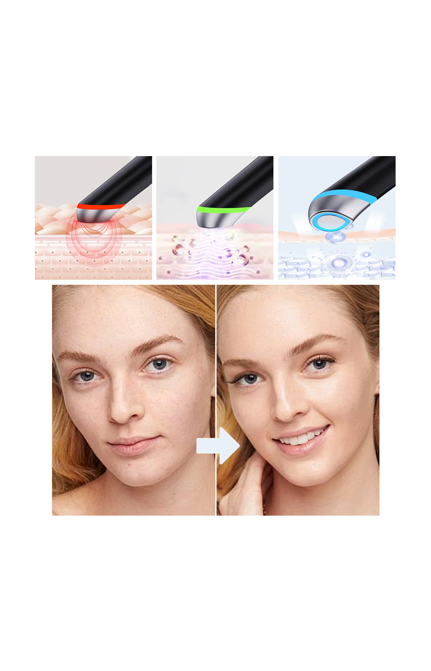 Appareil beauté 4-en-1 - Visage - Noir - Image 5