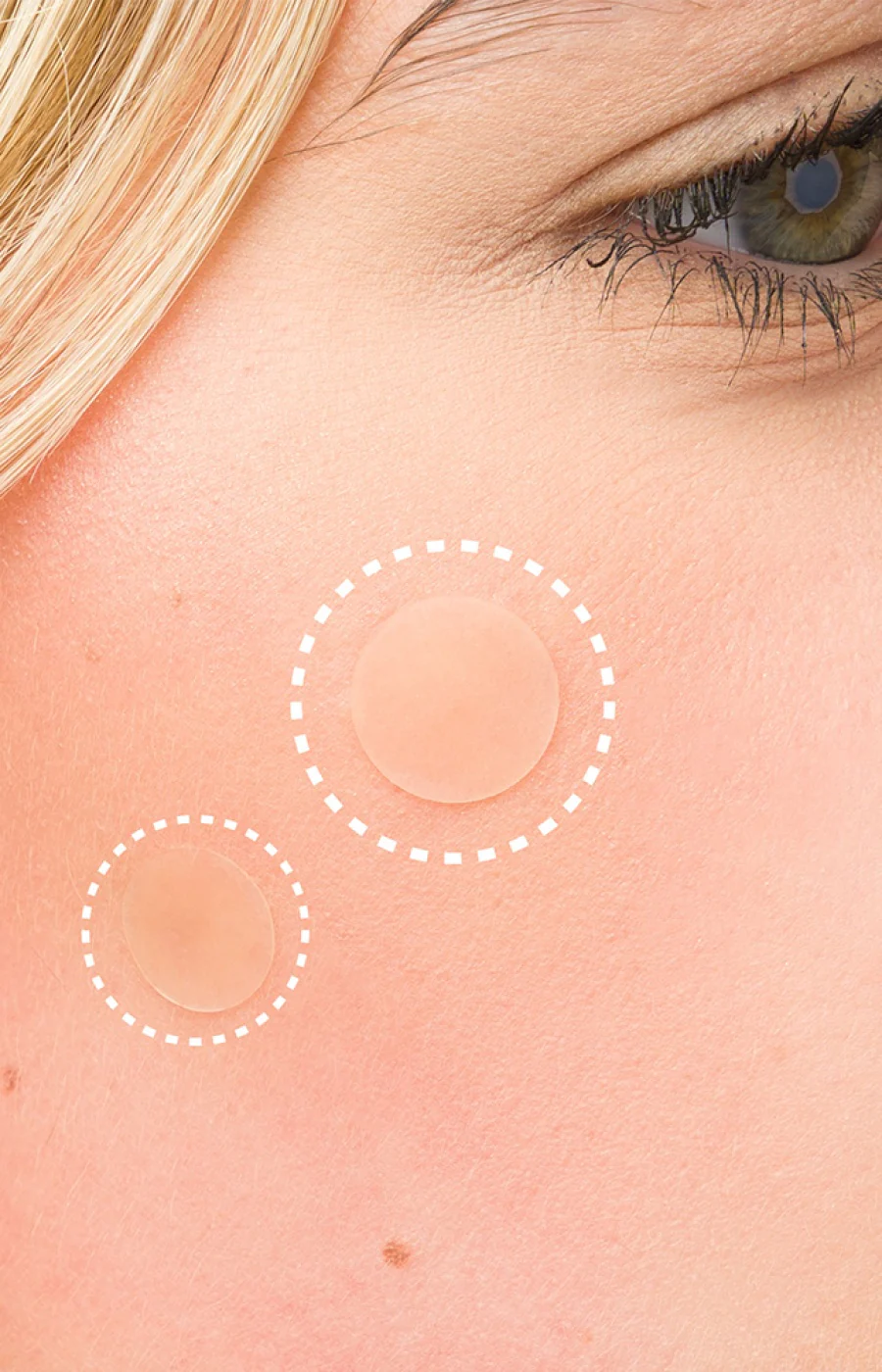 Patchs anti-imperfections - Tea tree & acide salicylique - Visage - 26 unités - Image 4