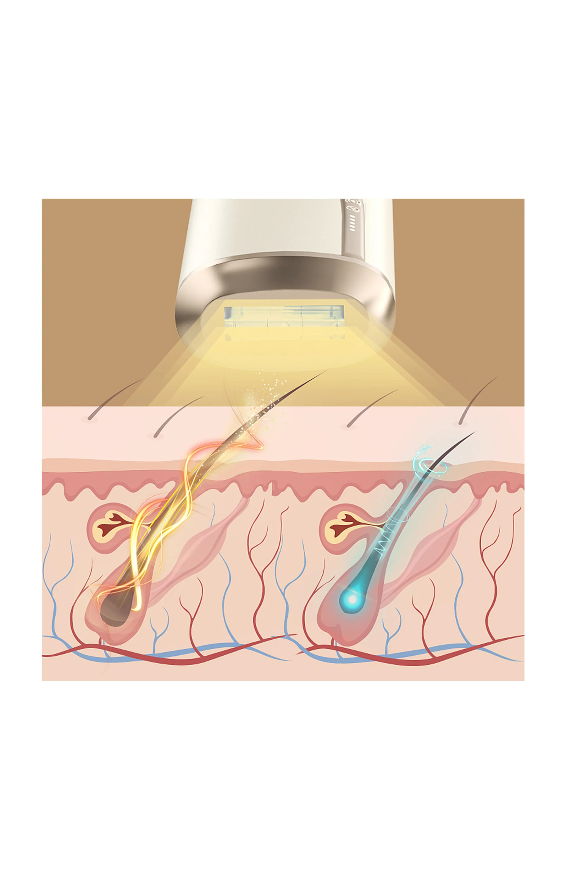 Épilateur lumière pulsée IPL - Corps & visage - Image 3