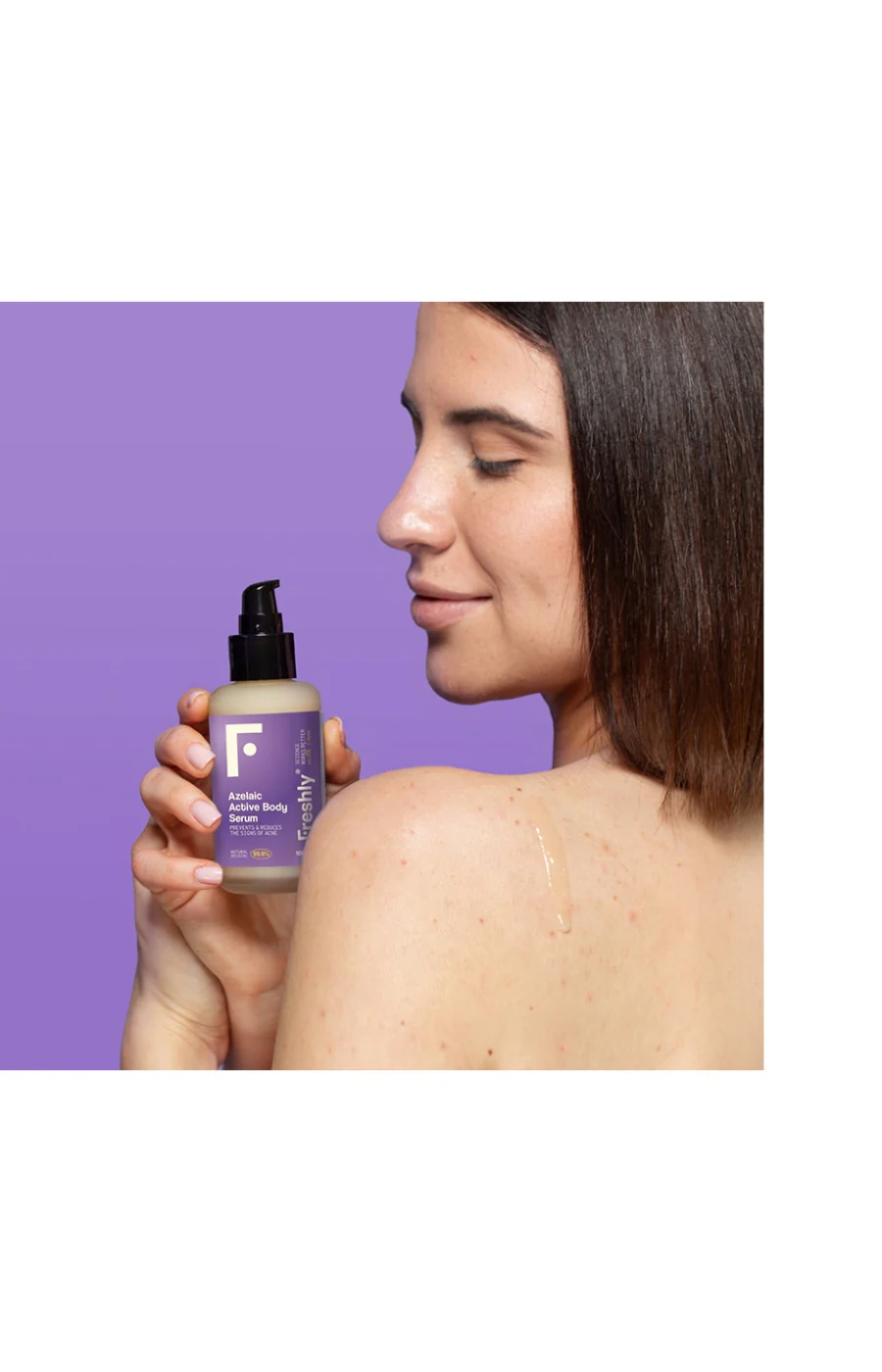 Soin anti-imperfections - Acide azélaique - Corps - 100 ml - Image 2