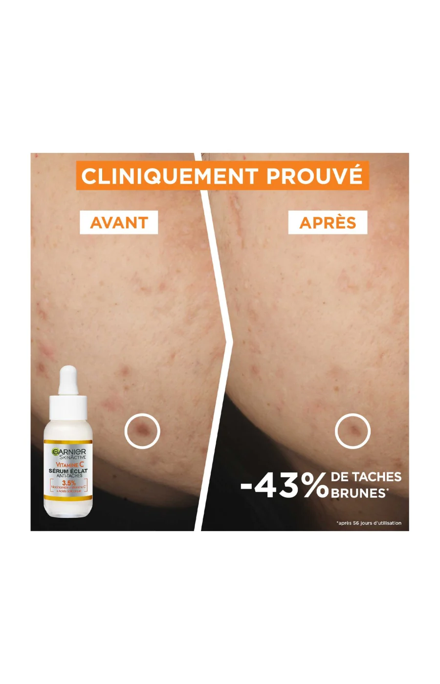 Sérum éclat anti-tâches - Vitamine C - Visage - Image 5