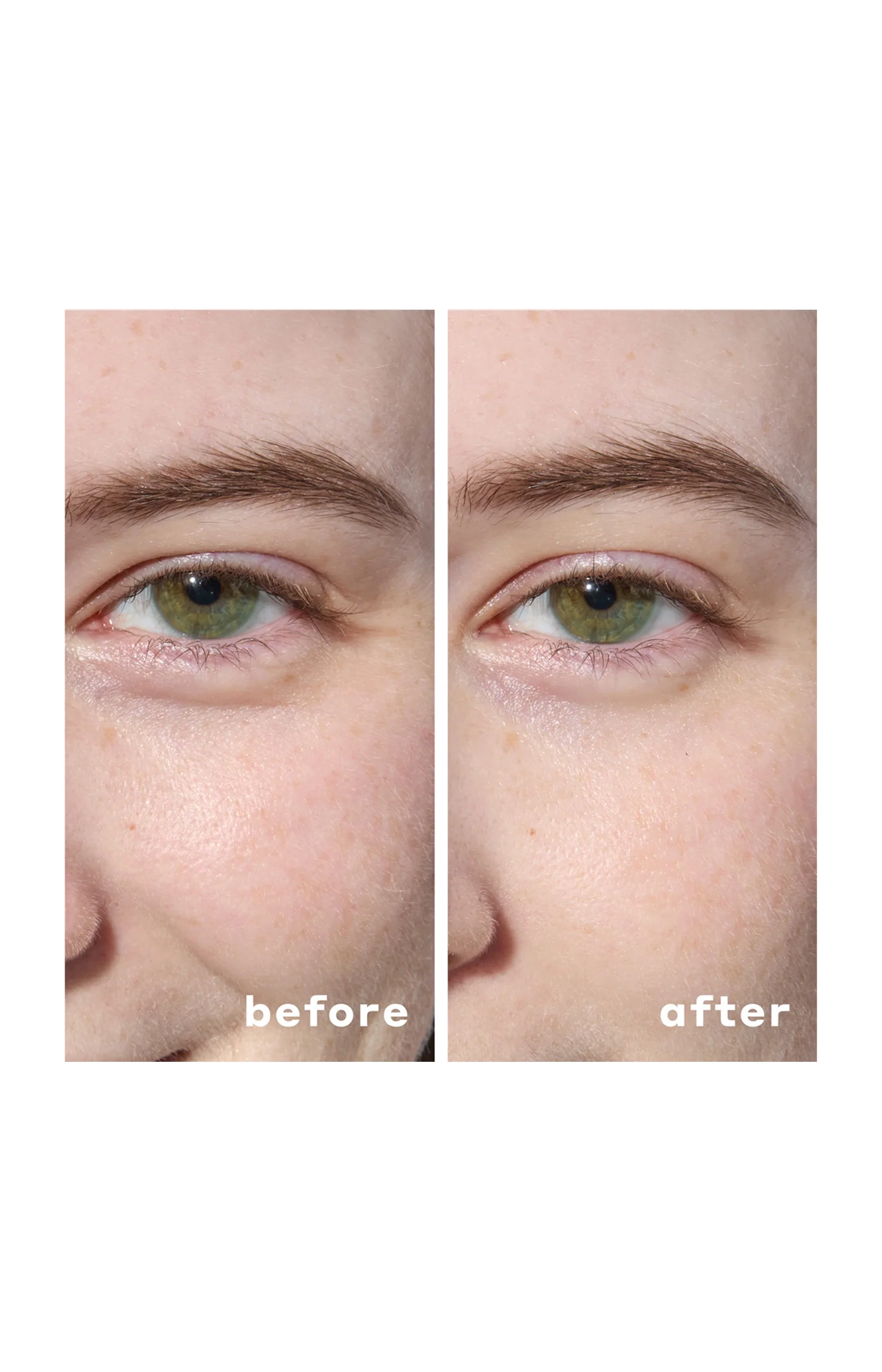 Patchs yeux hydrogel hydratants - Acide hyaluronique & niacinamide - 30 paires - Image 6