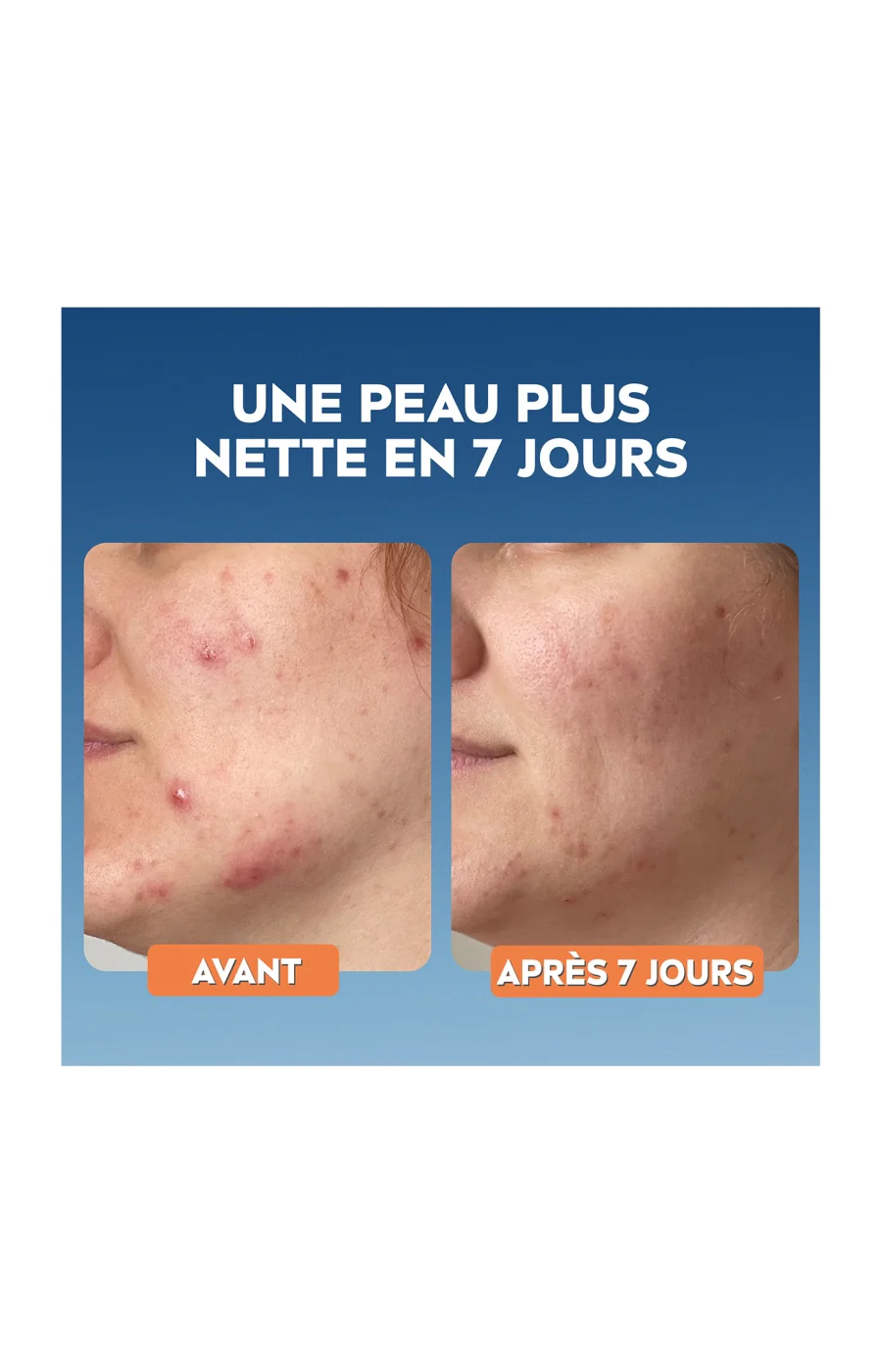 Sérum purifiant - Derma Skin Clear - Niacinamide & acide hyaluronique - Peaux à imperfections - 30 ml - Image 4