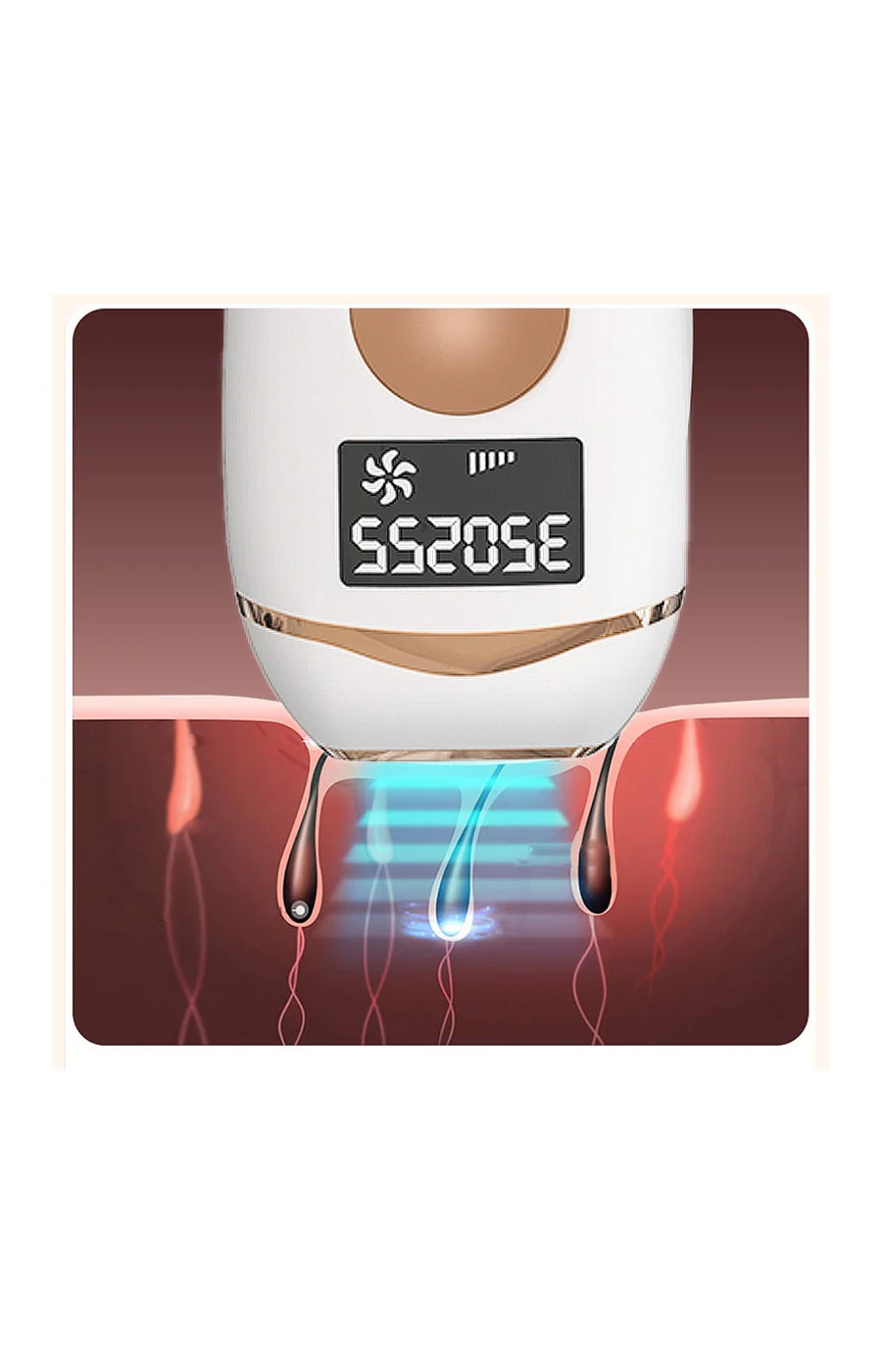 Épilateur IPL à lumière pulsée - 999 999 flashs - Corps - Image 5